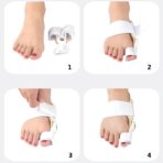 Adjustable Big Toe Splint Foot Bone Protrusion Overlapping Toe Separator Hallux Valgus Bunion Corrector（JD008T） - Image 4