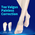 Bunion Pain Relief Hallux Valgus Correction Orthotic Insoles Nylon Breathable Soft Sport Adult Foot Orthotic（JD017T） - Image 3